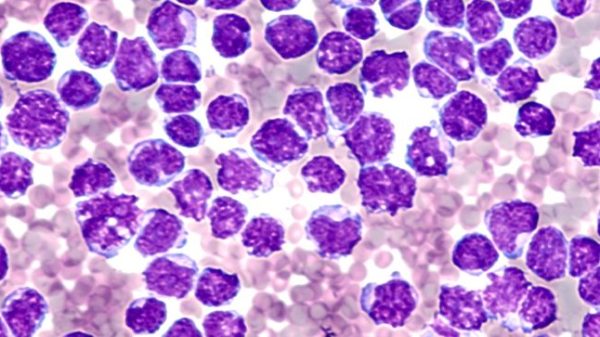 ΛΕΜΦΩΜΑ ΜΑΝΔΥΑΣ