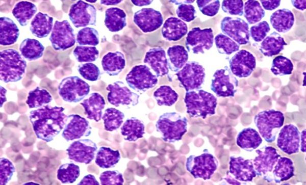 ΛΕΜΦΩΜΑ ΜΑΝΔΥΑΣ